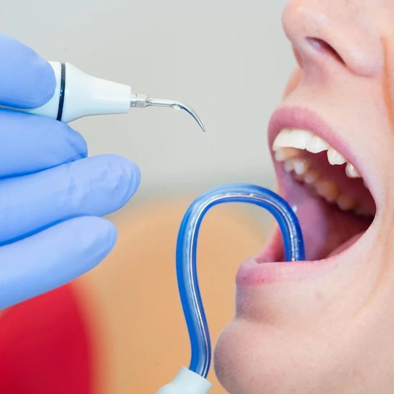 Czym zajmuje się periodontolog? Choroby przyzębia i więcej