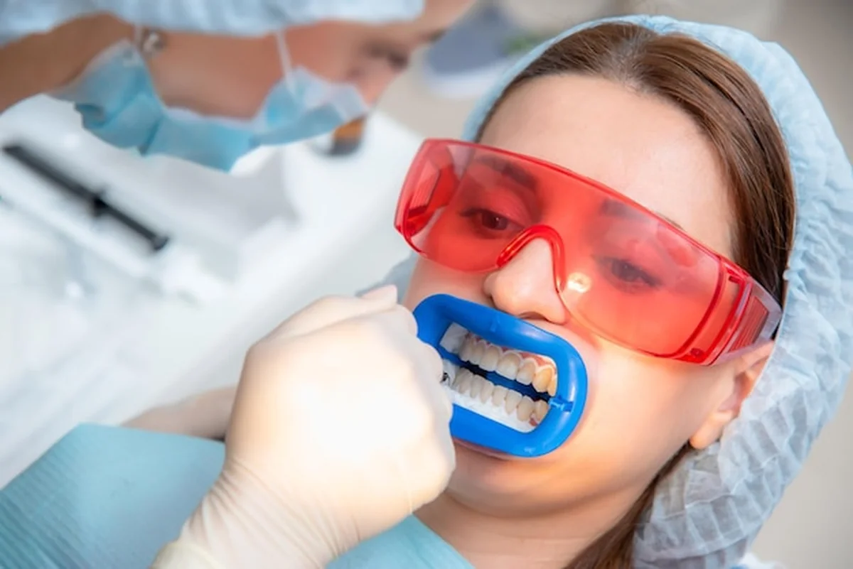 Przygotowanie jamy ustnej do wybielania lampą ultrafioletową