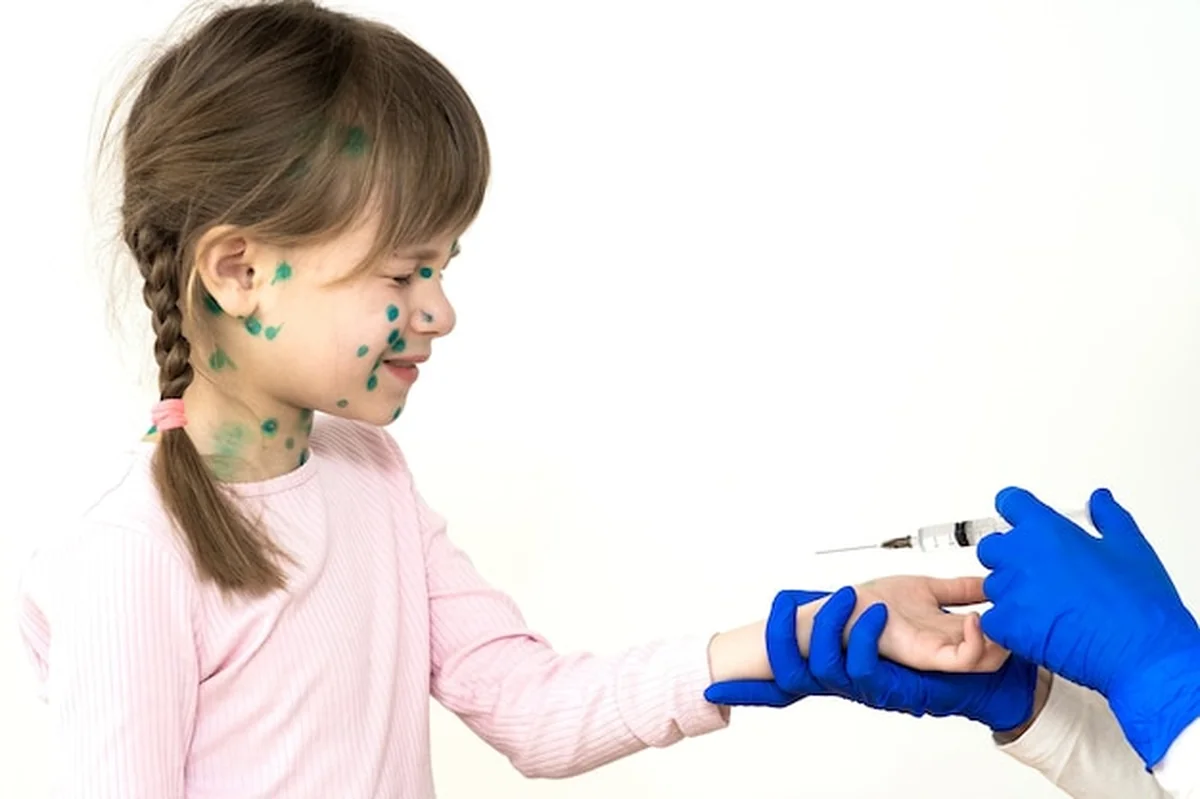 Lekarz robi zastrzyk szczepionki przestraszonej dziewczynce z ospą wietrzną