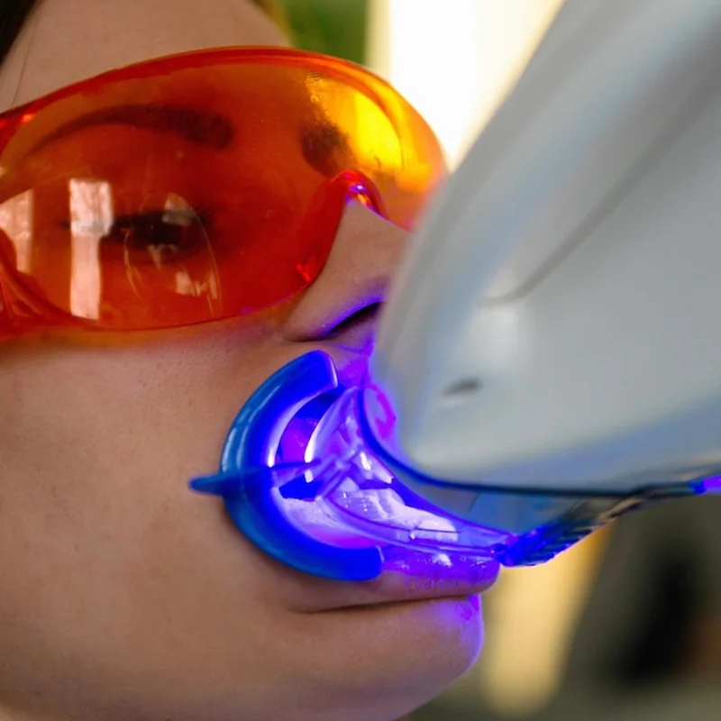 Lampa Beyond efekty wybielania zębów – co warto wiedzieć?